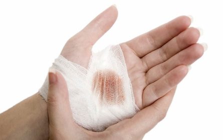 thực phẩm mau lành vết thương